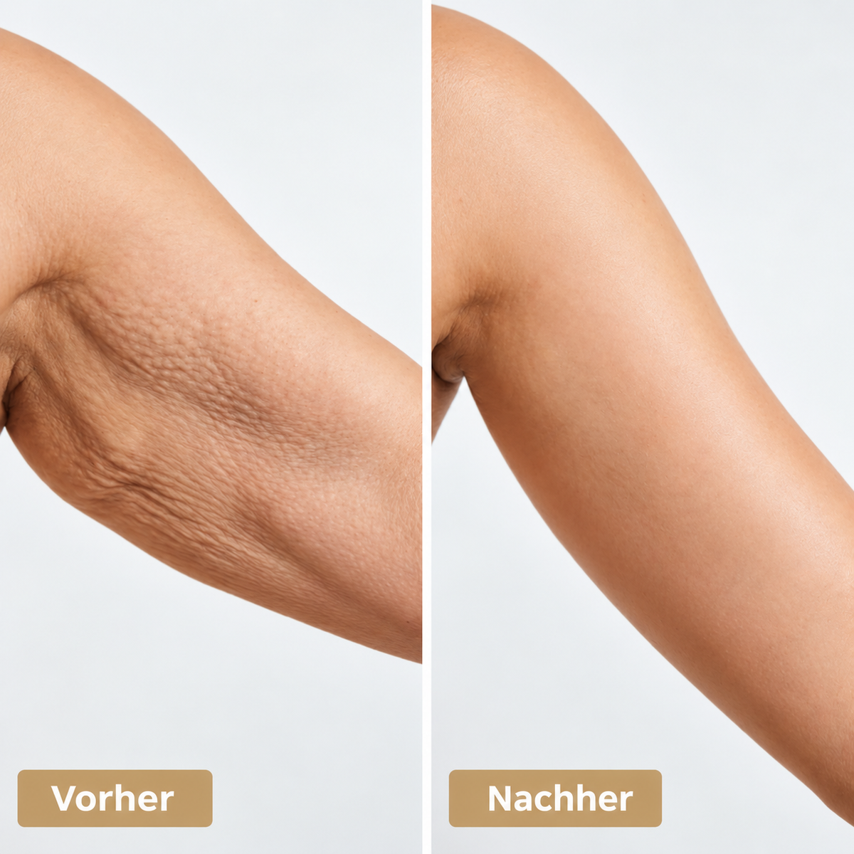 Hautstraffendes Körperöl gegen trockene & reif wirkende Haut – Anti-Aging Pflegeöl, 100 ml