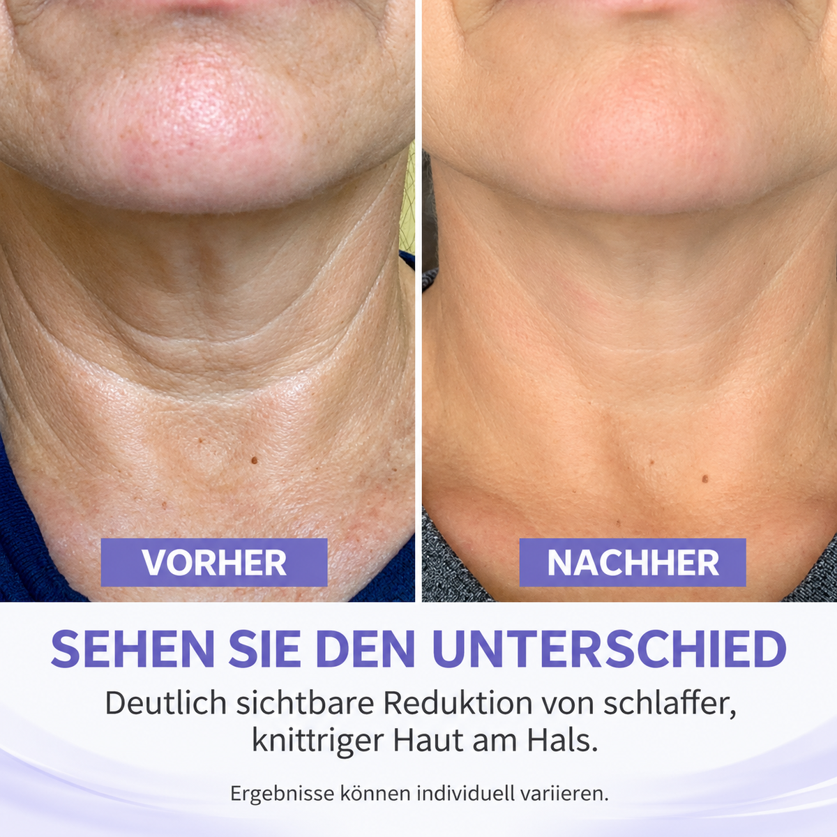Straffende Halscreme mit Hyaluronsäure & Koffein – Anti-Aging Pflege, 50 ml
